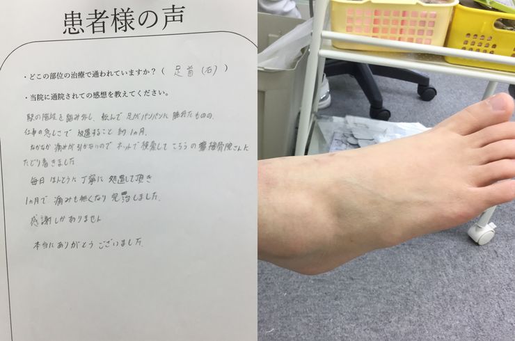 高橋陽子 右足首