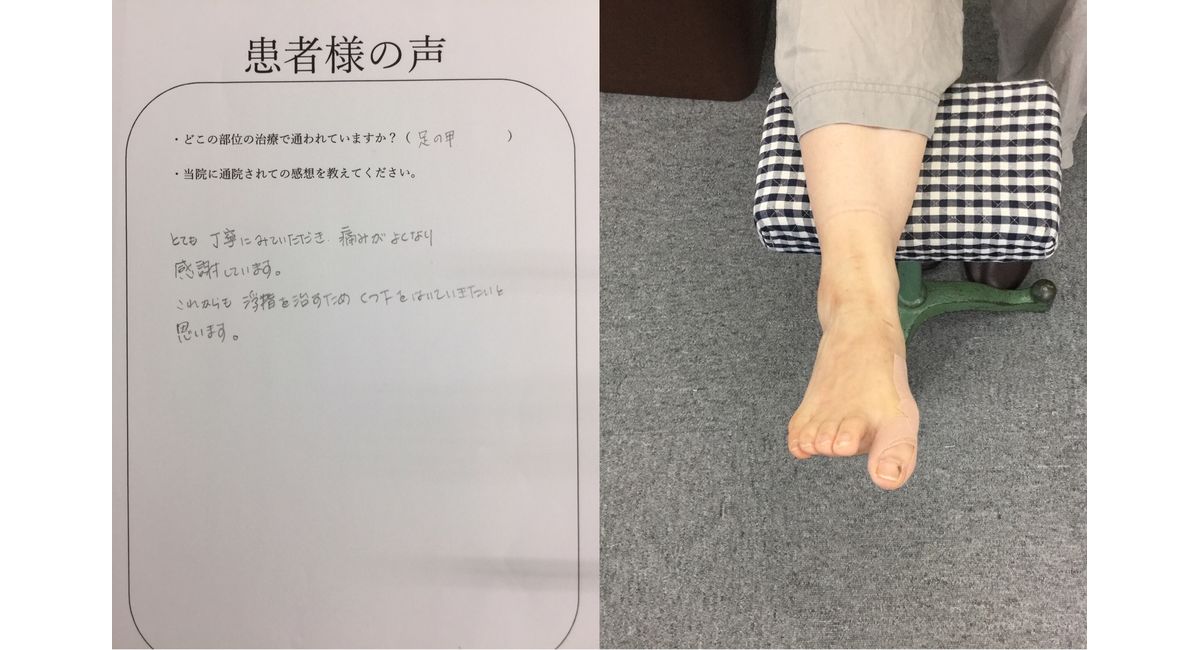 足の甲の痛み 50代女性の患者様 横浜の人気整骨院に寄せられた患者様の声をご覧ください 足の専門技術 外反母趾 足首捻挫 足 底筋膜炎は戸塚小林整骨院