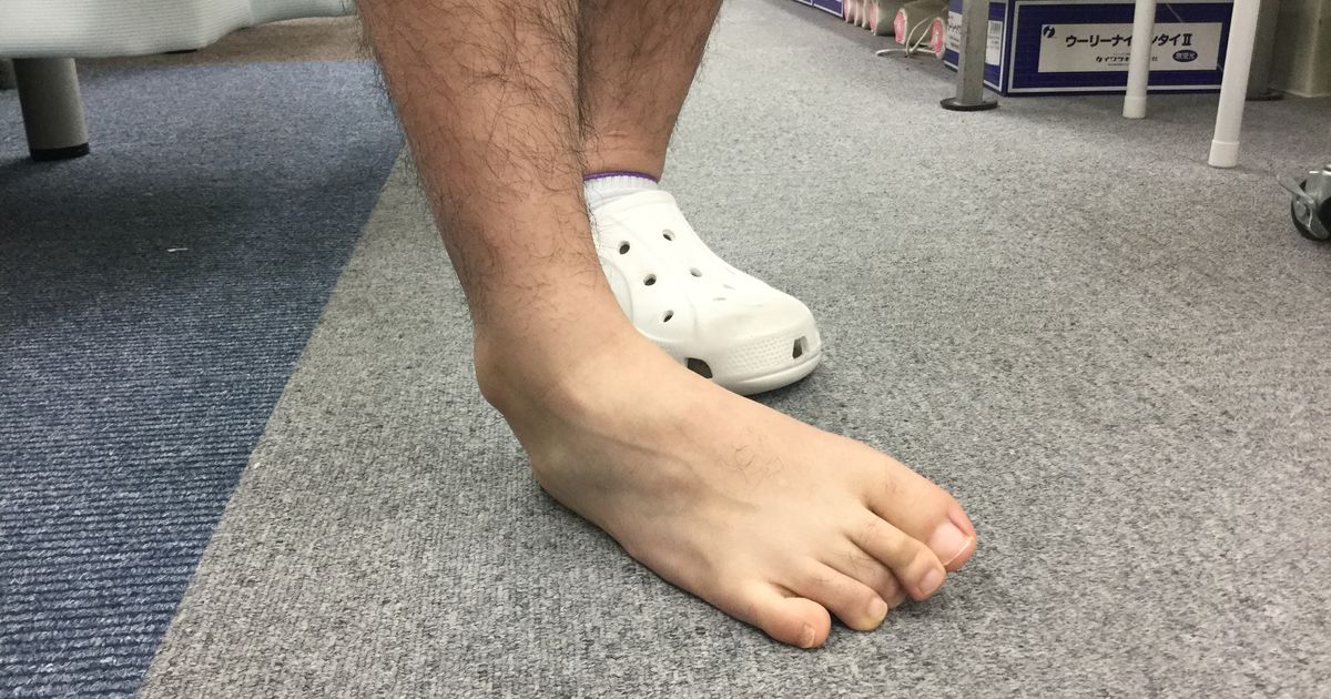 戸塚小林整骨院が変形足関節症について解明 足の不調 横浜で評判な接骨院のブログで初めてのご利用も安心です