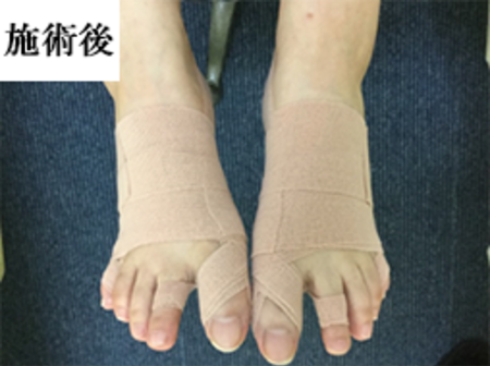 施術後