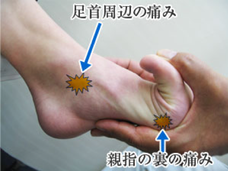 足の痛み種類２