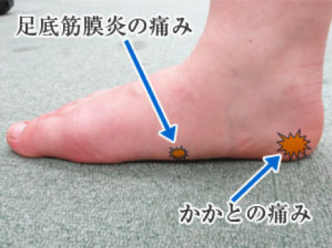 足の痛み種類３